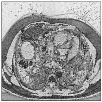 FUMPE Dataset